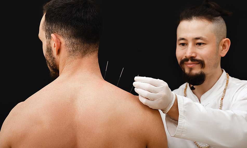 Acupuncture for Pain Relief