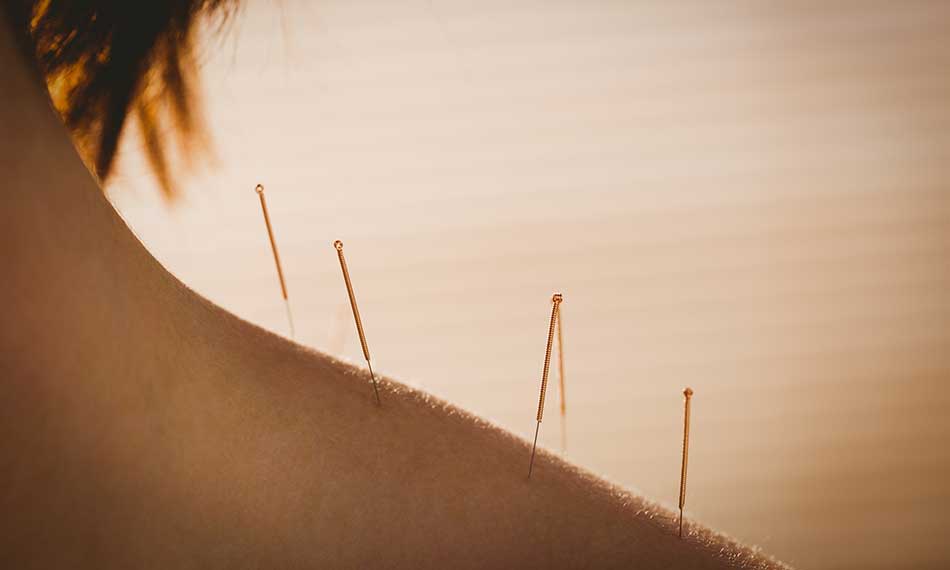 Stress and Anxiety Treatment