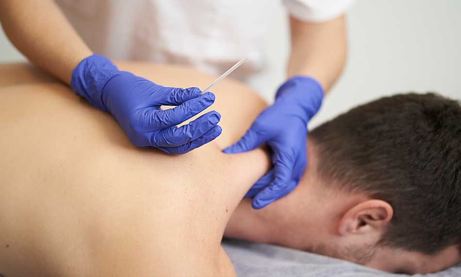 Acupuncture for Sports Injuries